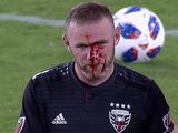 Уйэн Руни в матче за «Ди Си Юнайтед» получил перелом носа и рассечение (ФОТО)