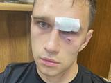 Избитый российским футболистом арбитр: «Если бы Широкова не оттащили, я был бы мертв»