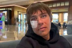 «Лицо Семейкина вы видели по телевизору», — врач «Шинника» рассказал о потерях после контакта с «Минаем» 