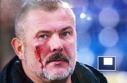 Ультрас «Днепра» избили президента «Днепра-1» и болельщиков клуба