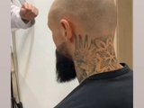 Бывший игрок «Динамо» решил сменить имидж, сделав пересадку волос (ФОТО)