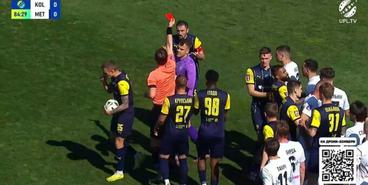 Удаление Калюжного