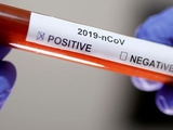 В «Брюгге» вспышка коронавируса: на утро понедельника — трое зараженных
