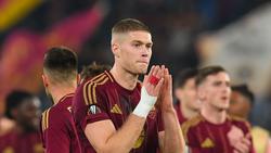 Спортивний лікар — про травму Довбика: «Дуже повчальна історія для всіх, а особливо клубного персоналу «Роми»