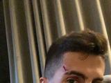 Четыре грабителя напали на защитника «Манчестер Сити». Футболисту разбили лицо (ФОТО)