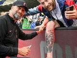 Jürgen Klopp hinterließ ein Autogramm am Fuß eines Fans (FOTO)