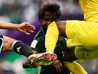 Еще одна жуткая травма ЧМ-2022. Вратарь Саудовской Аравии ударом колена сломал защитнику своей команды челюсть (ФОТО, ВИДЕО)