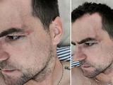 Анте Кулушич показал своё лицо после драки с Жерсоном Родригесом (ФОТО)