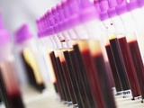 В бундеслиге в рамках борьбы с допингом будут брать анализ крови